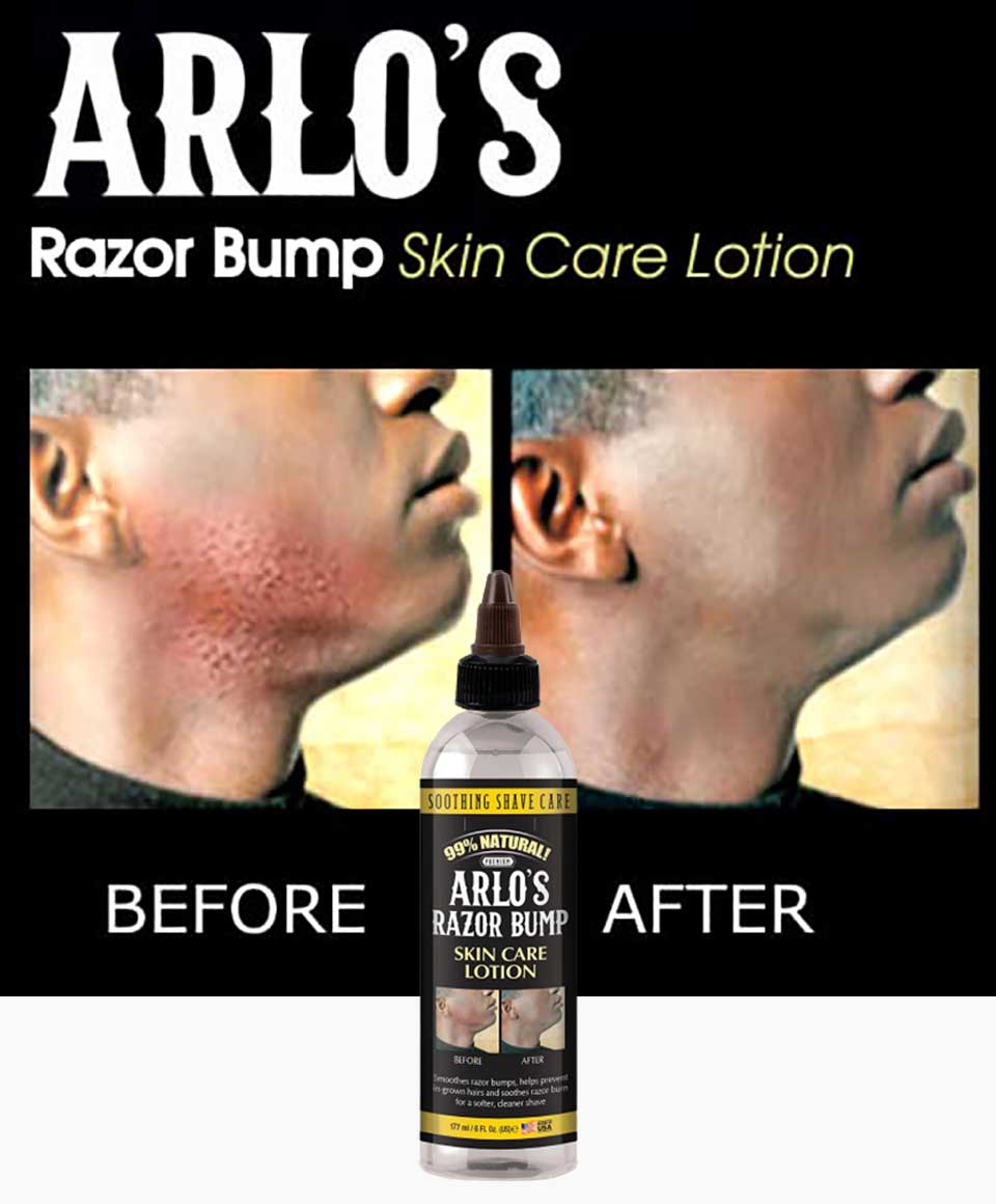 Razor Bump Skin Care Lotion