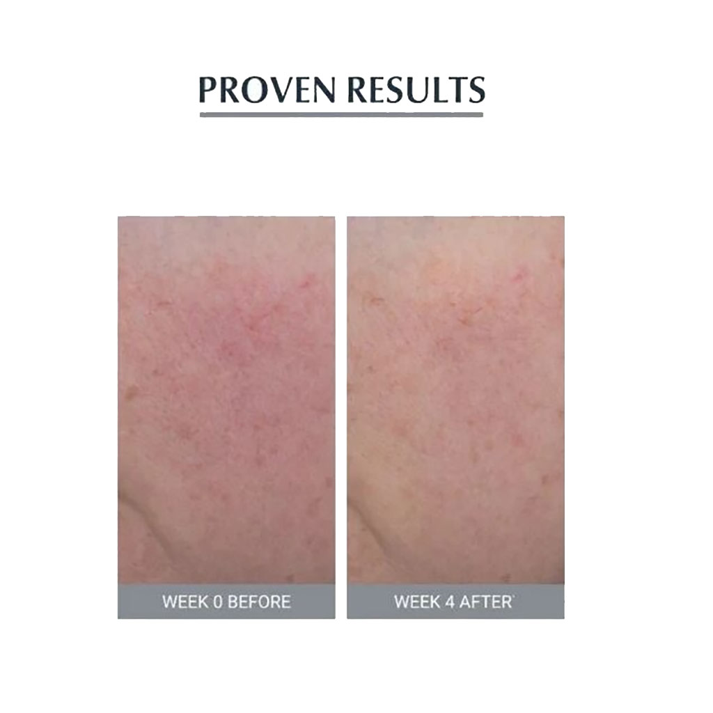 Anti Redness Soothing Care