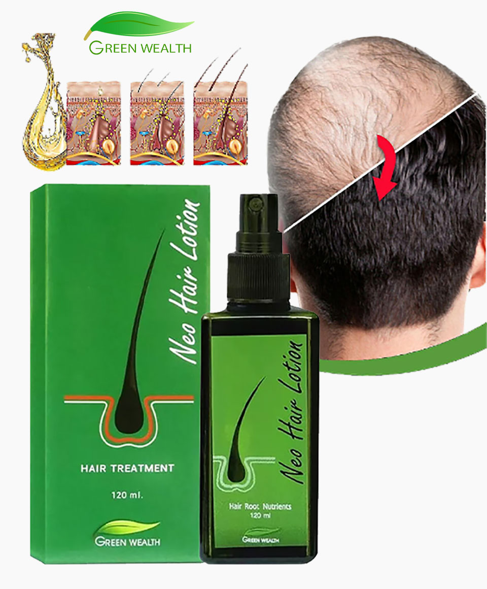 NEO Hair Lotion Hair Growth Treatment
