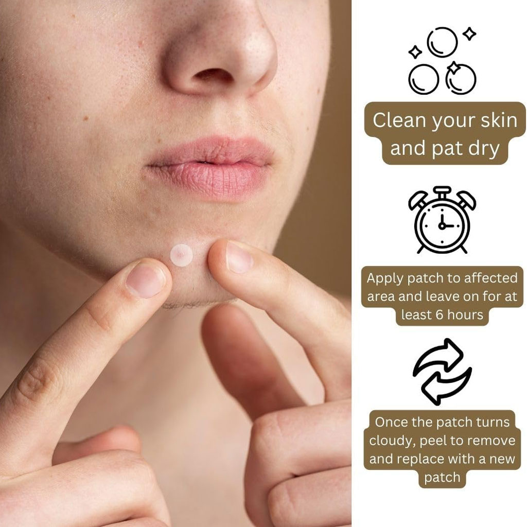 Derma V10 Spot Zapper Patches
