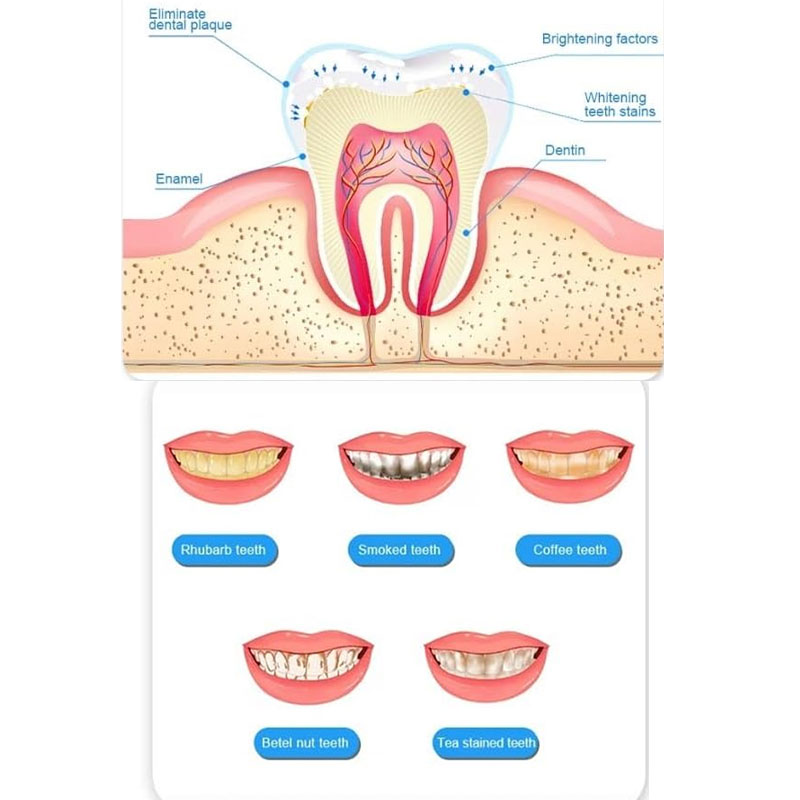 1 Pen Teeth Whitening Pen