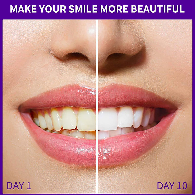 V34 Teeth Whitening Foam