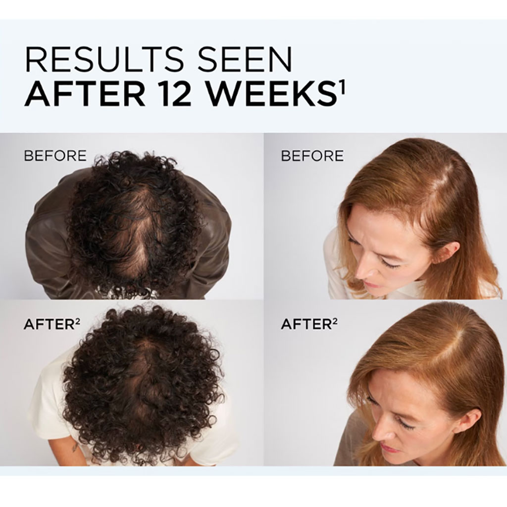 Elvive Growth Booster Anti Fall Conditioner